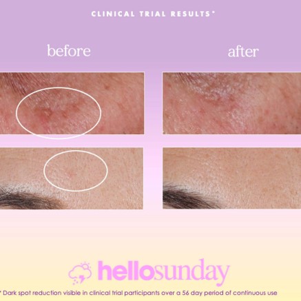 Siero Viso Hello Sunday The One That Makes You Glow Dark Spot SPF 40 ( 2