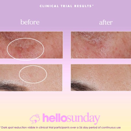 Sérum Facial Hello Sunday The One That Makes You Glow Dark Spot SPF 4