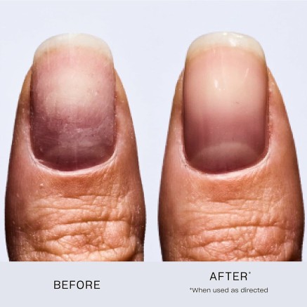 Nagellak Opi Nail Envy Origineel 15 ml Nagel Verharder 2
