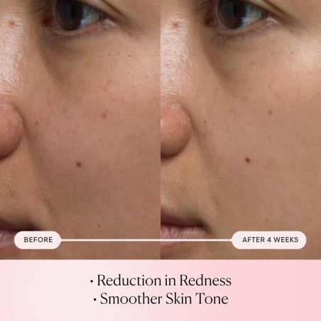 Siero Viso Elemis